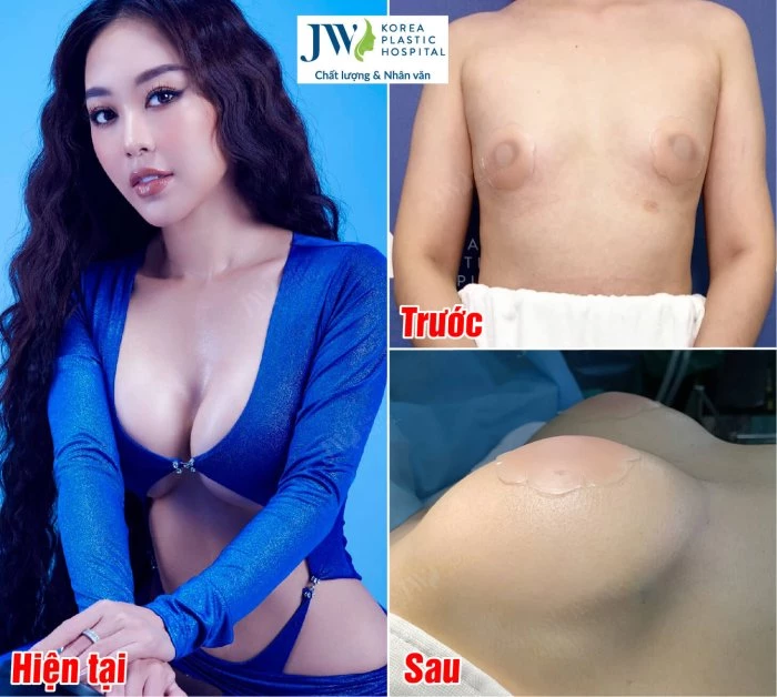 1000+ bộ ảnh gái ngực to, tròn, sexy nhất Việt Nam 